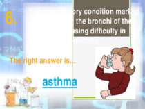It is a respiratory condition marked by spasm in the bronchi of the lungs, ca...