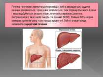 Печінка поступово зменшується в розмірах, тобто зморщується, судини печінки з...