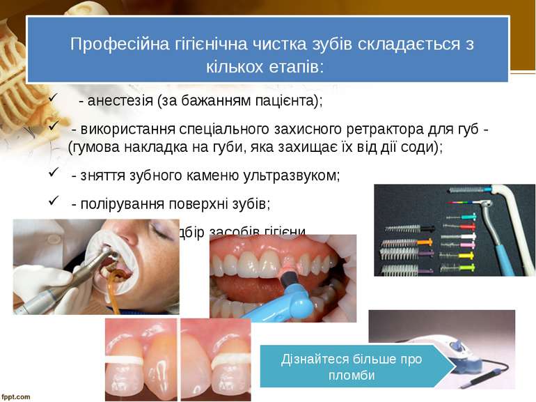 Професійна гігієнічна чистка зубів складається з кількох етапів: - анестезія ...