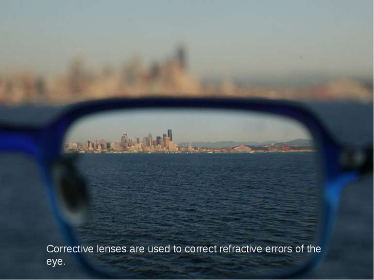 Corrective lenses are used to correct refractive errors of the eye.