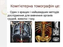 Комп'ютерна томографія це: - Один з кращих і найшвидших методів дослідження д...