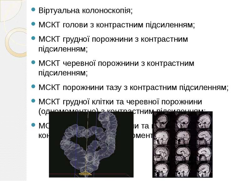 Віртуальна колоноскопія; МСКТ голови з контрастним підсиленням; МСКТ грудної ...