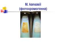 M. kansasii (фотохромогенна)