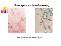 Mycobacterium tuberculosis Бактеріоскопічний метод