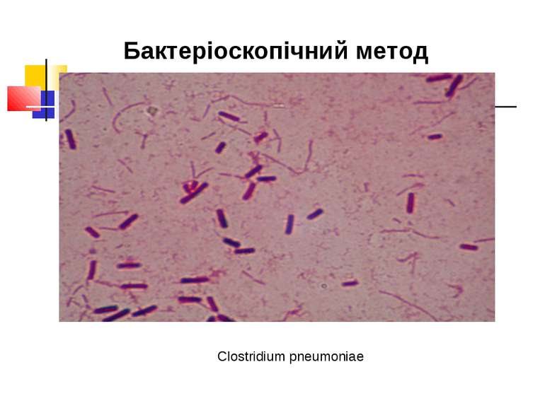 Бактеріоскопічний метод Clostridium pneumoniae