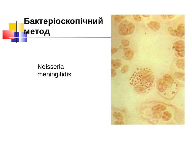 Neisseria meningitidis Бактеріоскопічний метод