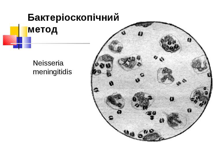 Neisseria meningitidis Бактеріоскопічний метод