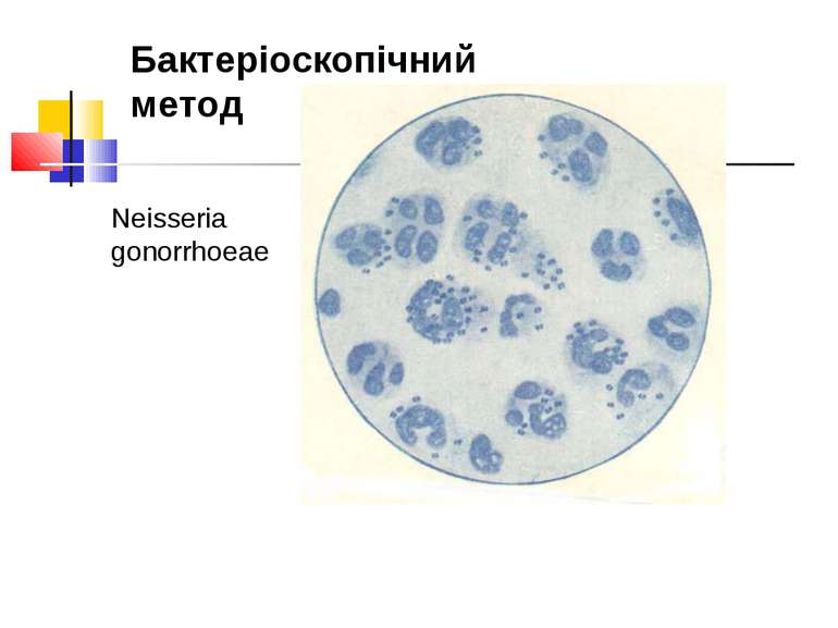 Neisseria gonorrhoeae Бактеріоскопічний метод