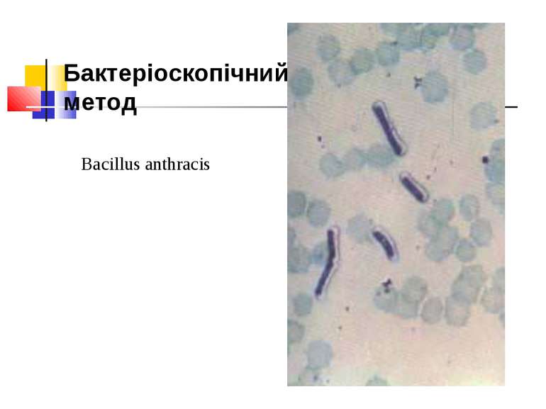Bacillus anthracis Бактеріоскопічний метод