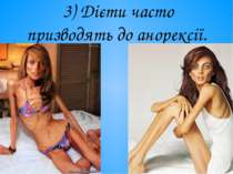 3) Дієти часто призводять до анорексії.