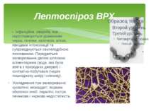 Лептоспіроз ВРХ -  інфекційна  хвороба, яка характеризується ураженням нирок,...
