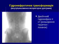 Гідронефротична трансформація (внутрішньовенна екскреторна урограма) Двобічни...