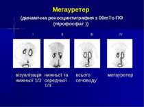 Мегауретер (динамічна реносцинтиграфия з 99mTc-ПФ (пірофосфат )) І ІІ ІІІ IV