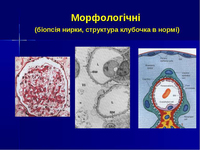 Морфологічні (біопсія нирки, структура клубочка в нормі)