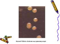 Колонії Vibrio cholerae на лужному агарі