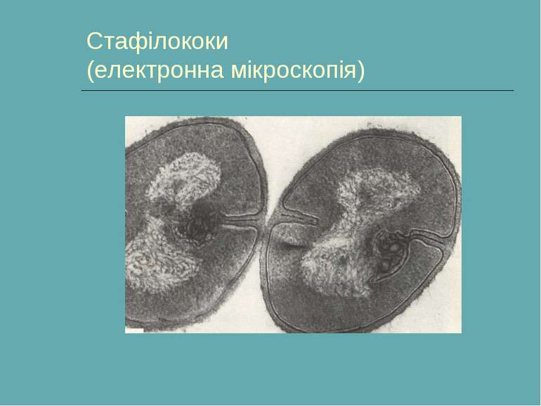 Стафілококи (електронна мікроскопія)