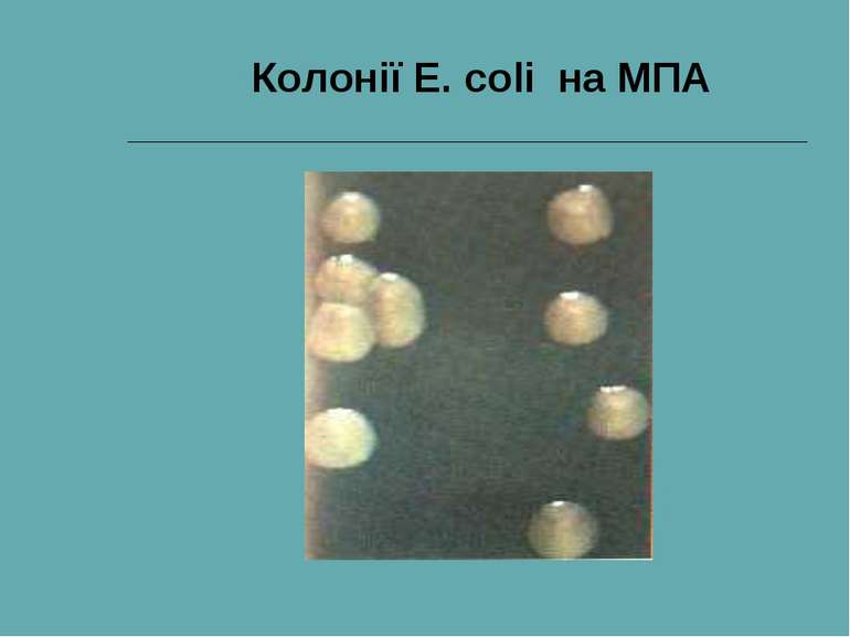 Колонії E. coli на МПА
