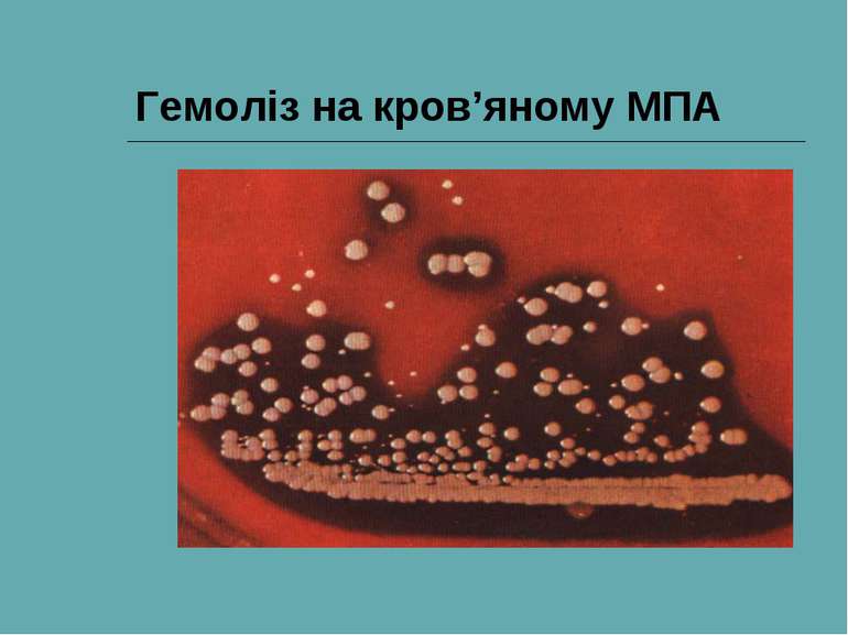 Гемоліз на кров’яному МПА