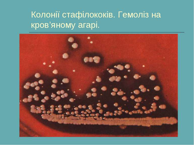 Колонії стафілококів. Гемоліз на кров’яному агарі.