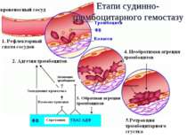Етапи судинно-тромбоцитарного гемостазу