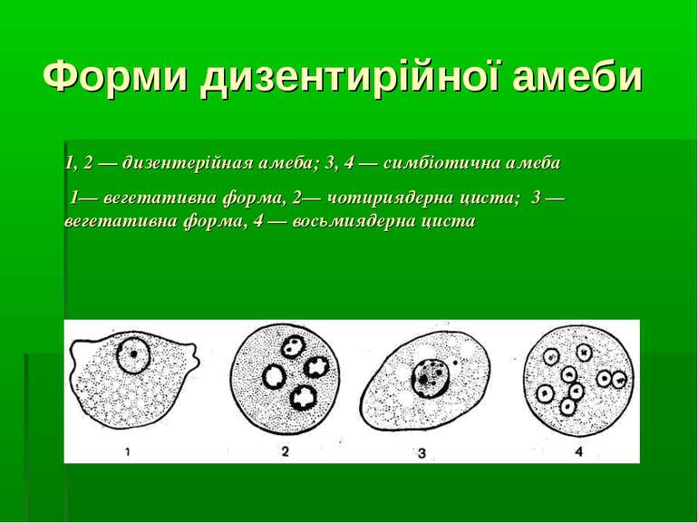 Форми дизентирійної амеби 1, 2 — дизентерійная амеба; 3, 4 — симбіотична амеб...