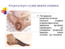 Атеросклероз судин нижніх кінцівок Погіршення кровопостачання нижньої кінцівк...
