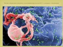 Штучне забарвлення скануючим електронним мікроскопом ВІЛ-1, в зеленому, з від...