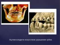 Ацтеки владели искусством украшения зубов.