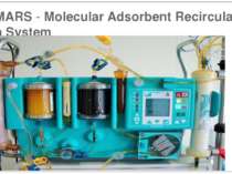 MARS - Molecular Adsorbent Recirculation System