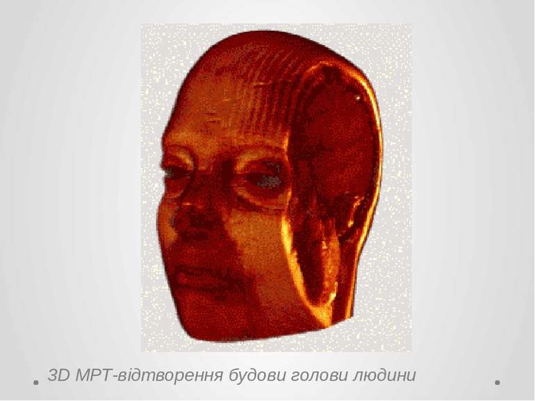 3D МРТ-відтворення будови голови людини