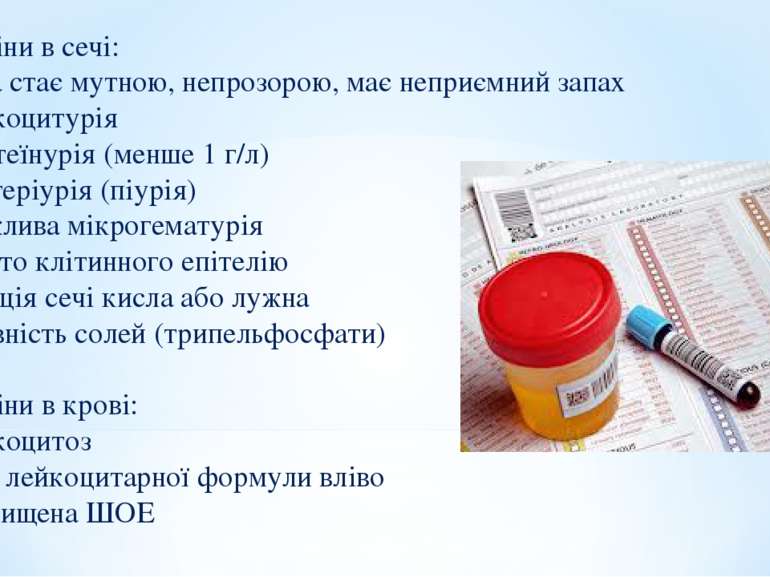 5. Зміни в сечі: Сеча стає мутною, непрозорою, має неприємний запах Лейкоциту...