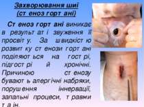 Захворювання шиї (стеноз гортані) Стеноз гортані виникає в результаті звуженн...