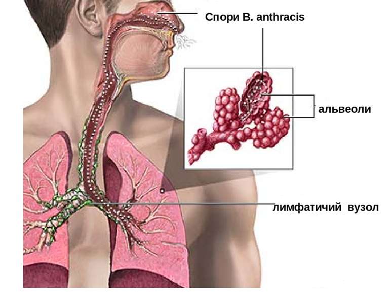 Спори В. anthracis альвеоли лимфатичий вузол