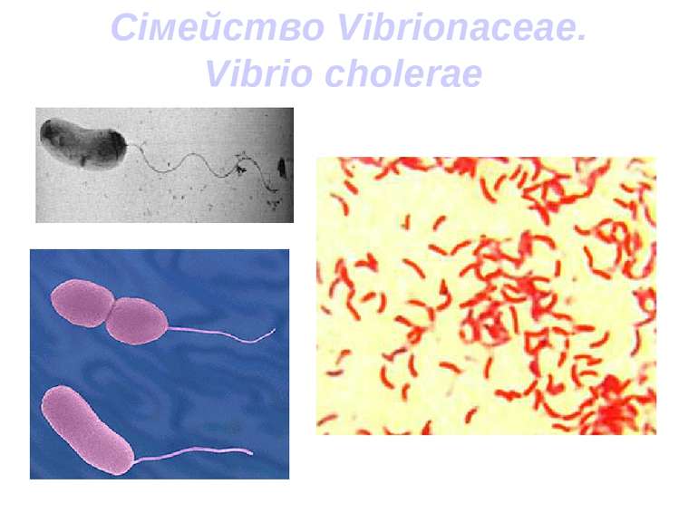 Сімейство Vibrionaceae. Vibrio cholerae