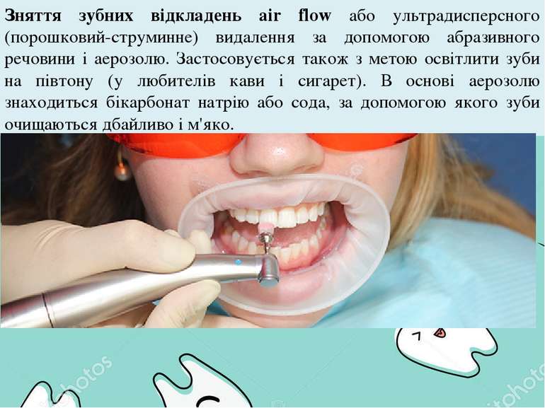 Зняття зубних відкладень air flow або ультрадисперсного (порошковий-струминне...