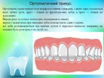 Ортогнатія характеризується морфологічними ознаками, з яких одні стосуються в...