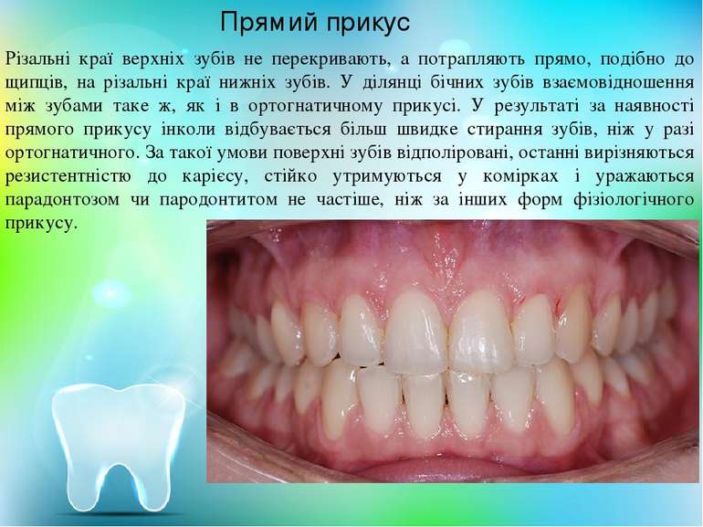 Різальні краї верхніх зубів не перекривають, а потрапляють прямо, подібно до ...