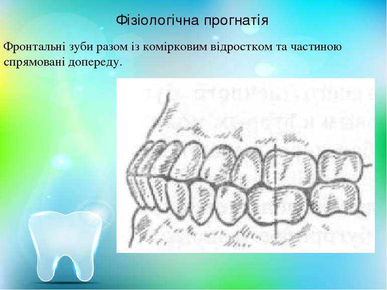 Фізіологічна прогнатія Фронтальні зуби разом із комірковим відростком та част...