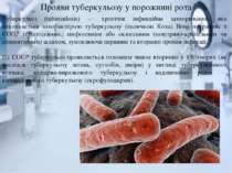 Прояви туберкульозу у порожнині рота Туберкульоз (tuberculosis) — хронічне ін...