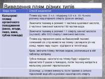 Виведення плям різних типів Видиплям Спосібвидалення Кольоровіплямиорганічног...