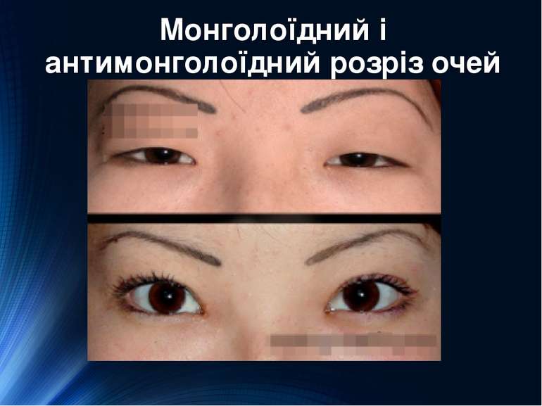 Монголоїдний і антимонголоїдний розріз очей