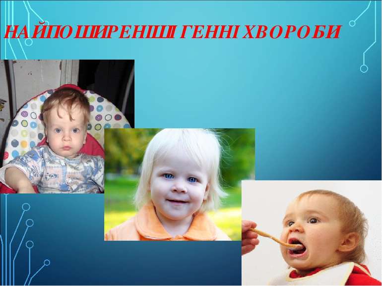 НАЙПОШИРЕНІШІ ГЕННІ ХВОРОБИ