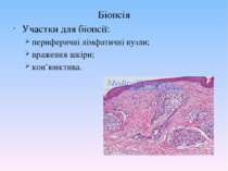 Біопсія Участки для біопсії: периферичні лімфатичні вузли; враження шкіри; ко...
