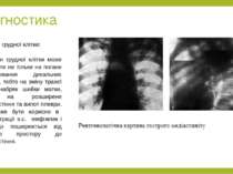 Діагностика Рентген грудної клітки:   Рентген грудної клітки може вказувати н...