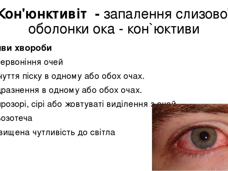 Кон'юнктивіт  - запалення слизової оболонки ока - кон`юктиви Прояви хвороби П...