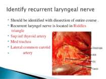 Should be identified with dissection of entire course . Recurrent laryngel ne...