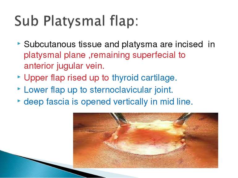 Subcutanous tissue and platysma are incised in platysmal plane ,remaining sup...