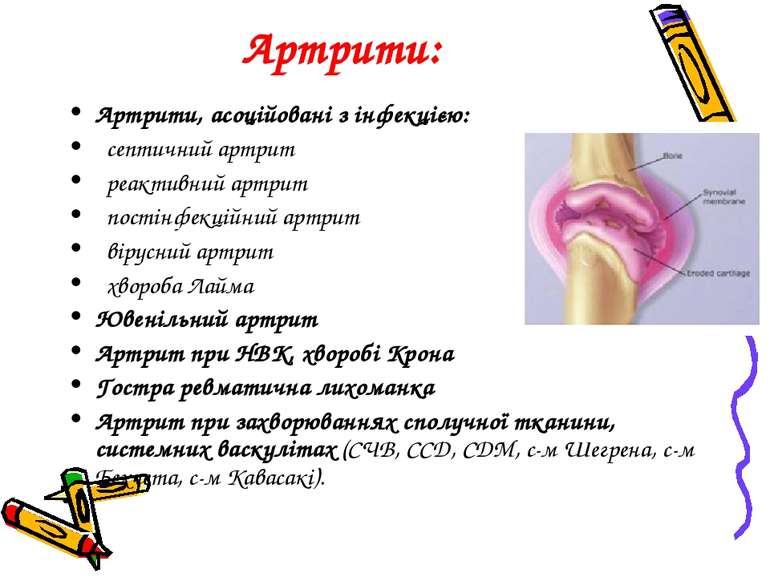 Артрити: Артрити, асоційовані з інфекцією: септичний артрит реактивний артрит...