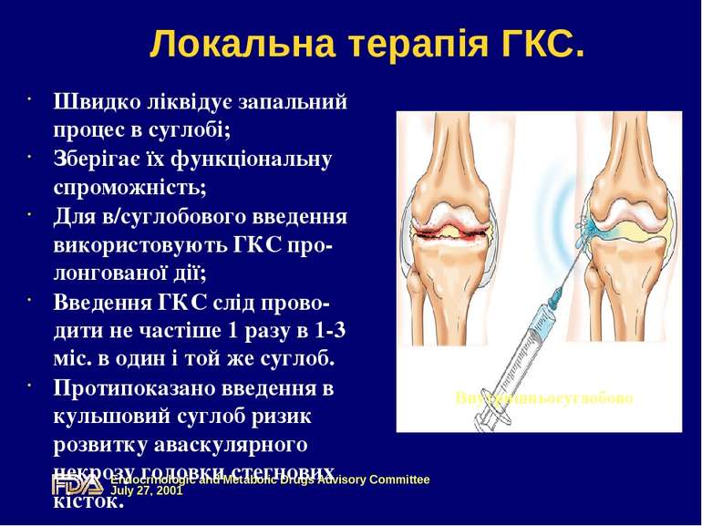 Внутришньосуглобово Локальна терапія ГКС. Швидко ліквідує запальний процес в ...