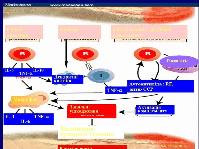 Зменшення хрящової тканини Запальні ушкодження Активація комплементу Синтез ц...